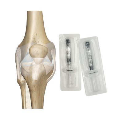 Osteoartritis Inyección de gel hialurónico Inyección hialurónica Rodilla Lubricación de rodilla