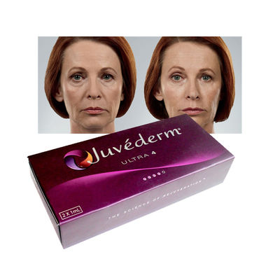 Relleno dérmico de ácido hialurónico Ultra3 Juvederm 20 mg/ml Rellenos para mejorar los labios