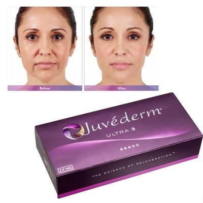 Ácido hialurónico Juvederm Gel de relleno facial Piel lisa e impecable