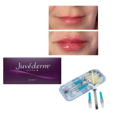 6-9 meses de duración Juvederm Dermal Filler Gel para la compra en línea y en la tienda