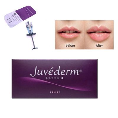 Allergan Juvederm Ultra4 inyección de relleno dérmico con Lido