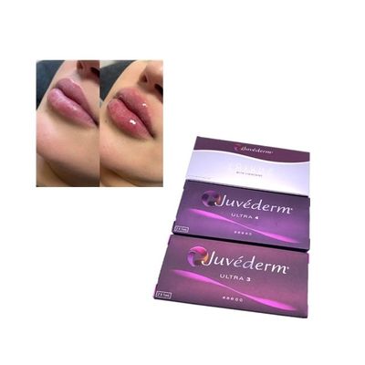 Juvederm Voluma para inyección Relleno cutáneo cruzado