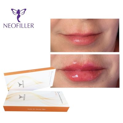 gel inyectable del llenador cutáneo del ácido hialurónico de 1ml aumento natural del rejuvenecimiento facial de 9-12 meses