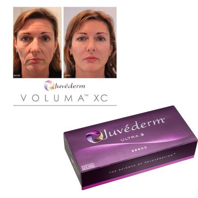 Corrección de arrugas Juvederm Relleno dérmico Ácido hialurónico Gel inyectable Tratamiento suavizante de larga duración