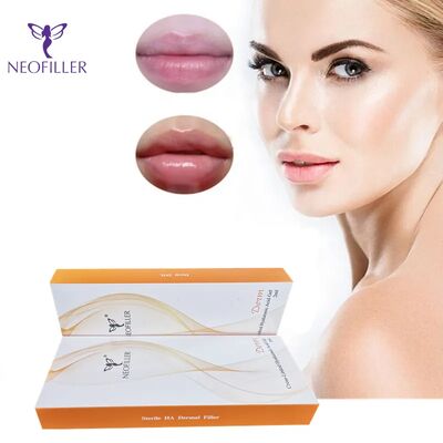 Ácido hialurónico interconectado Relleno dérmico Rejuvenecimiento facial Gel inyectable Mejora de la regeneración natural de la piel