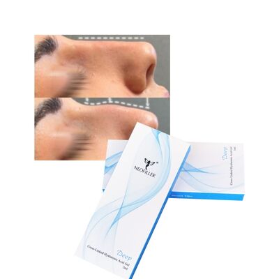 Mejora facial del gel inyectable del contorno de la nariz de la línea profunda del llenador dérmico del ácido hialurónico reticulado 2ml