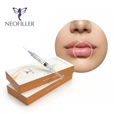 Neofiller Ácido hialurónico Relleno dérmico labios faciales nariz mejilla Gel inyectable Solución de almacenamiento a 2-25 °C