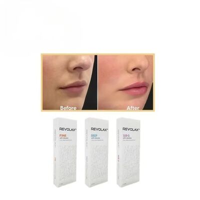 Sí Concentración de Ha 24mg Gel inyectable para contorno facial y volumen