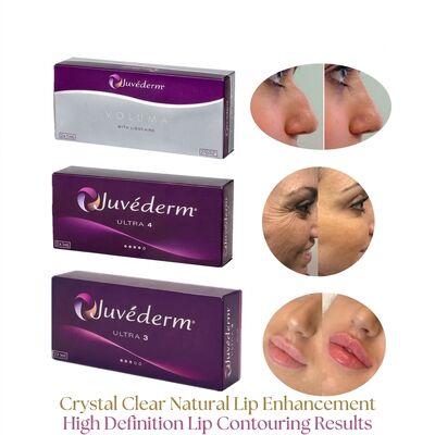 Volumen de la jeringa 2 1 ml por caja Juvederm Volumen de relleno Seguridad Contouring facial Relleno cutáneo inyectable para aumentar el volumen