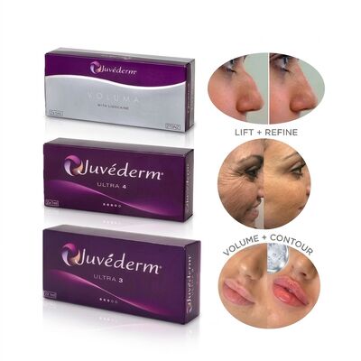 Juvederm Ultra 4 Relleno de nariz Relleno cutáneo con ácido hialurónico para rinoplastia no quirúrgica Reshaping de nariz