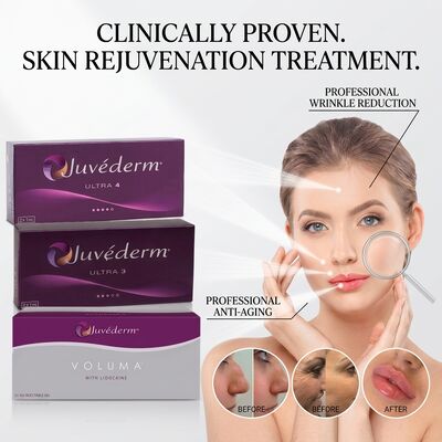 Relleno de surcos nasogenianos Juvederm Ultra 3 Ácido Hialurónico Relleno Dérmico para Suavizar Líneas de Expresión 24mg/ml