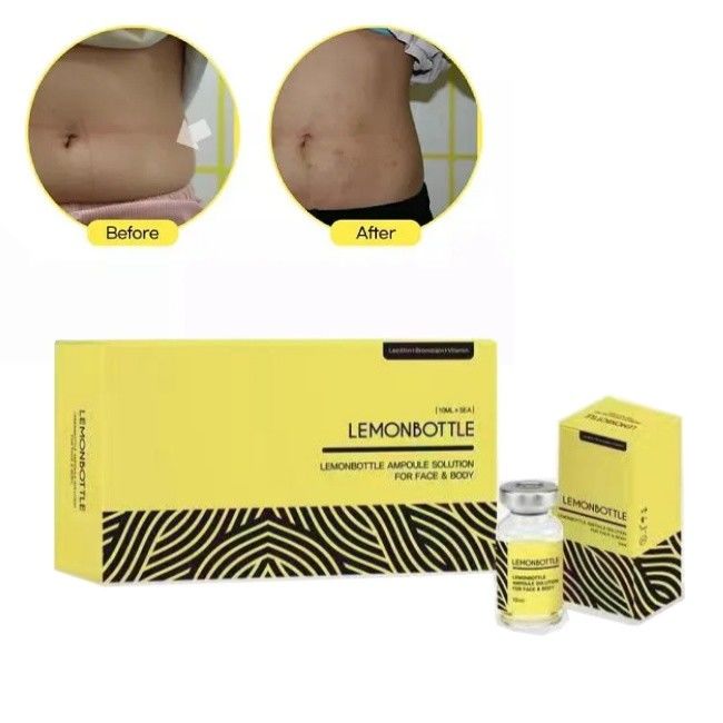 Solución de botella de limón de alta concentración para inyecciones de disolución de grasa 5 viales X 10 ml de cuerpo entero