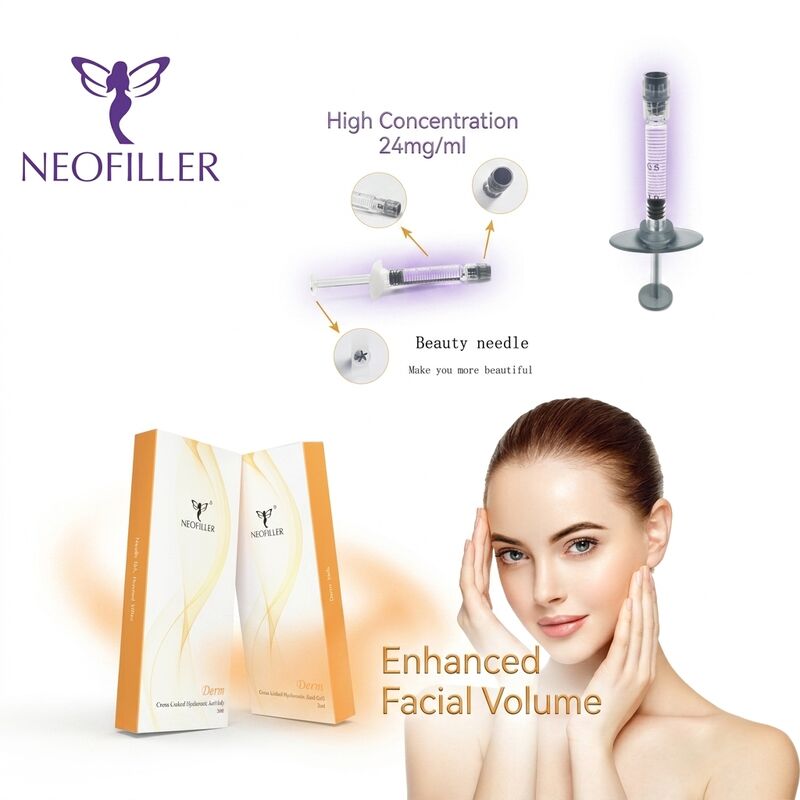 Jeringa estéril de 1ml, relleno dérmico de ácido hialurónico, gel inyectable reticulado biocompatible, estante de 24 meses para contorno facial