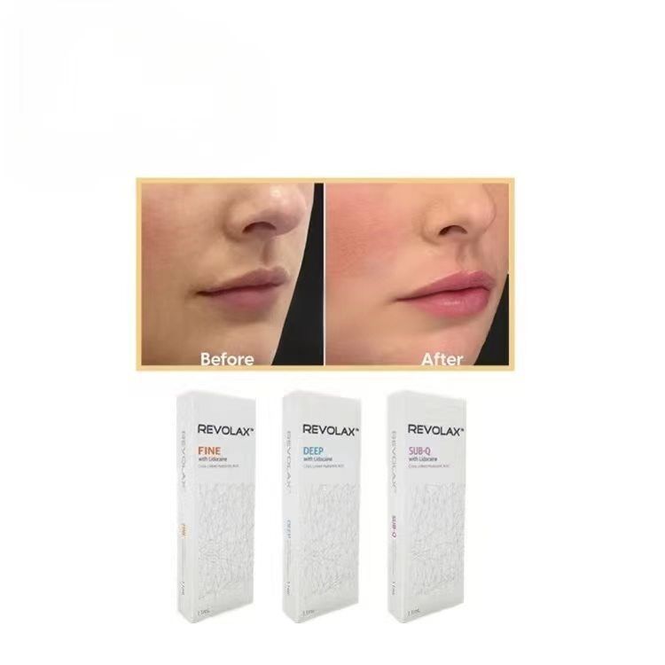 Sí Concentración de Ha 24mg Gel inyectable para contorno facial y volumen