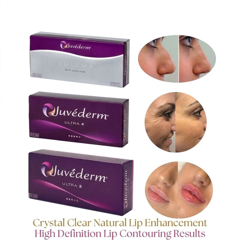 Volumen de la jeringa 2 1 ml por caja Juvederm Volumen de relleno Seguridad Contouring facial Relleno cutáneo inyectable para aumentar el volumen